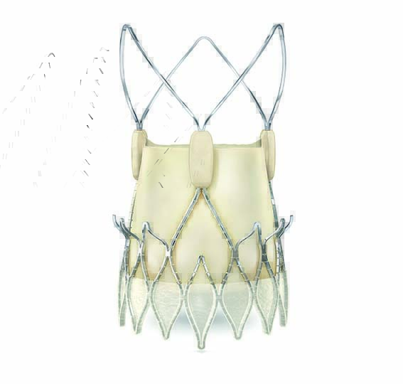 Acurate-neo-1.jpg ACURATE neo2™ - Transcatheter Aortic Valve System