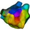Rhythmia NEW-FINAL.image.460.0 RHYTHMIA HDx™ - Mapping System