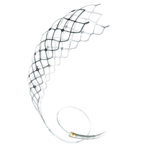 Catchview - Revascularization Device