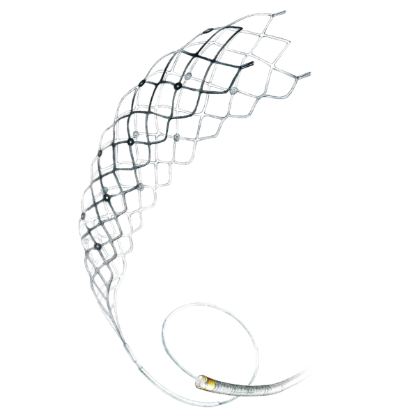 Catchview - Revascularization Device