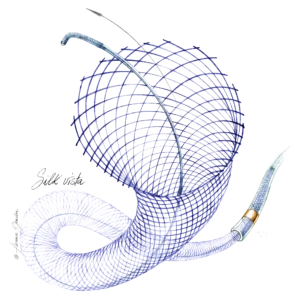 Silk Vista - Flow Diverter