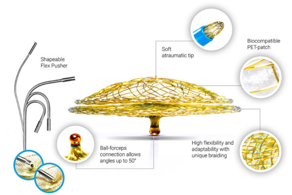 pfo_design-ny Occlutech PFO Occluder